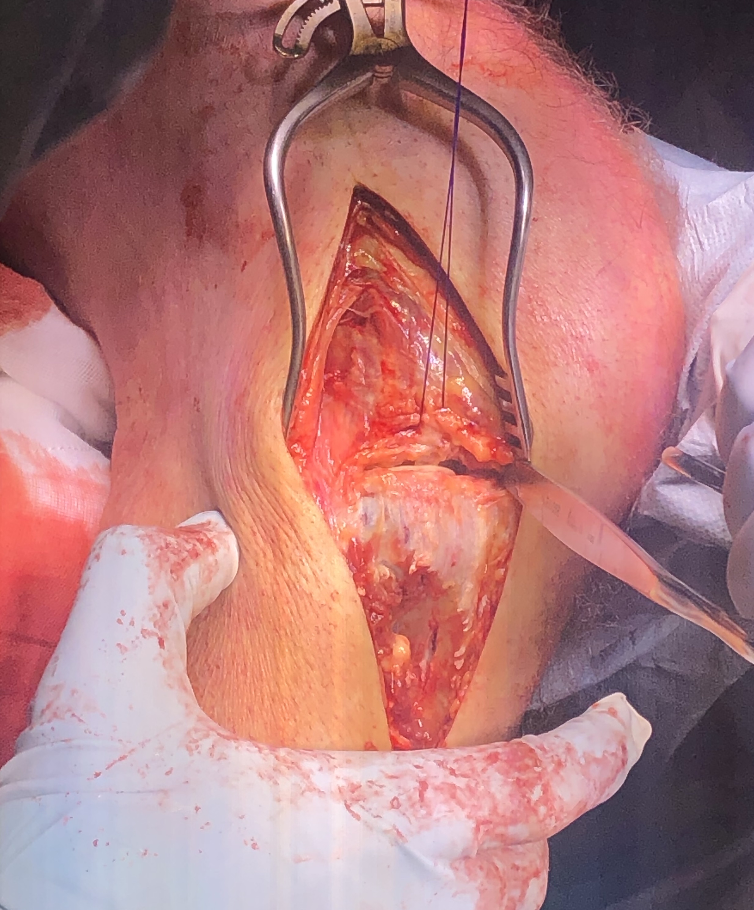 Anterolateral Approach Knee